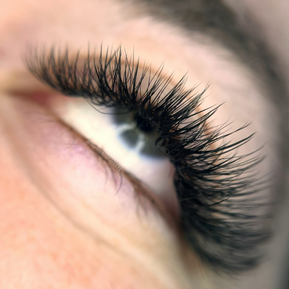 Transfer Fill at Stormy Aesthetics in Clearwater, FL