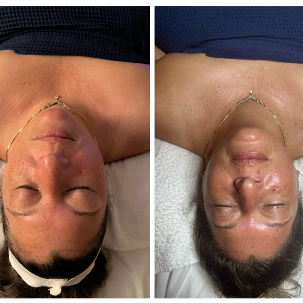 Sigh Correct 🦢 Tier 2 Facial at Sigh Beauty Bar in Merritt Island, FL