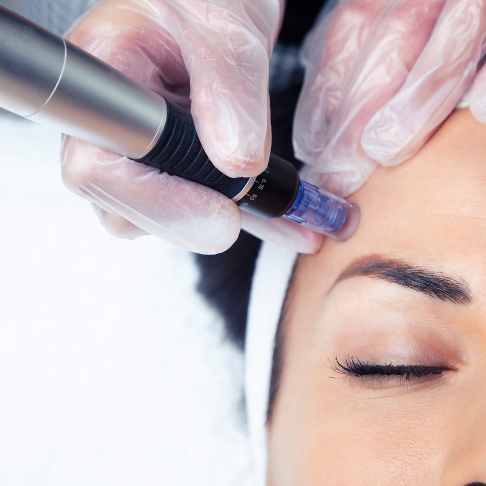 Beauty Facial