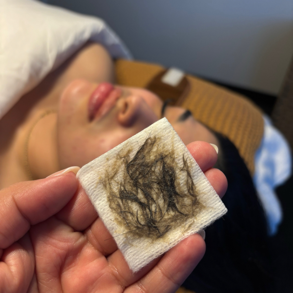 Express Facial Or Dermaplane at Esthetic Bar Retreat in Canoga Park, CA