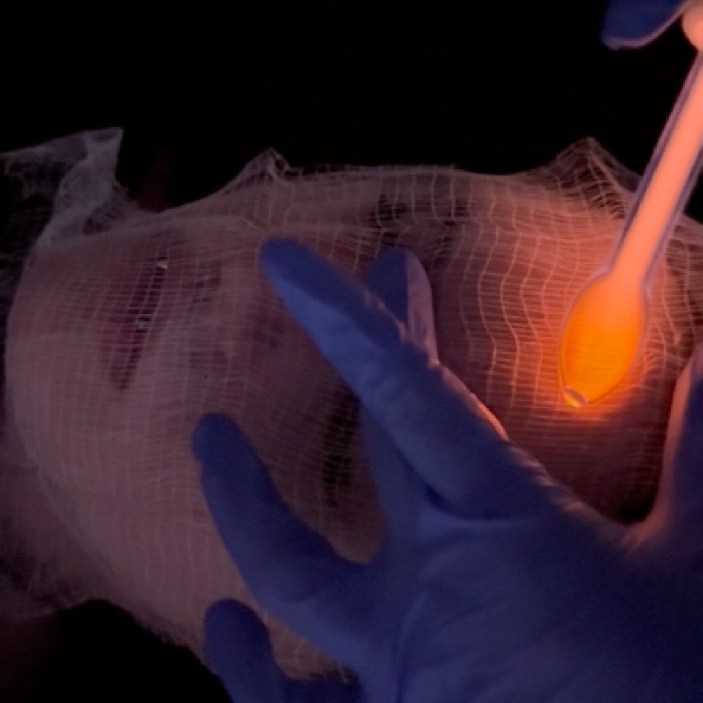 High Frequency Facial at Aesthetically You in Minneola, FL