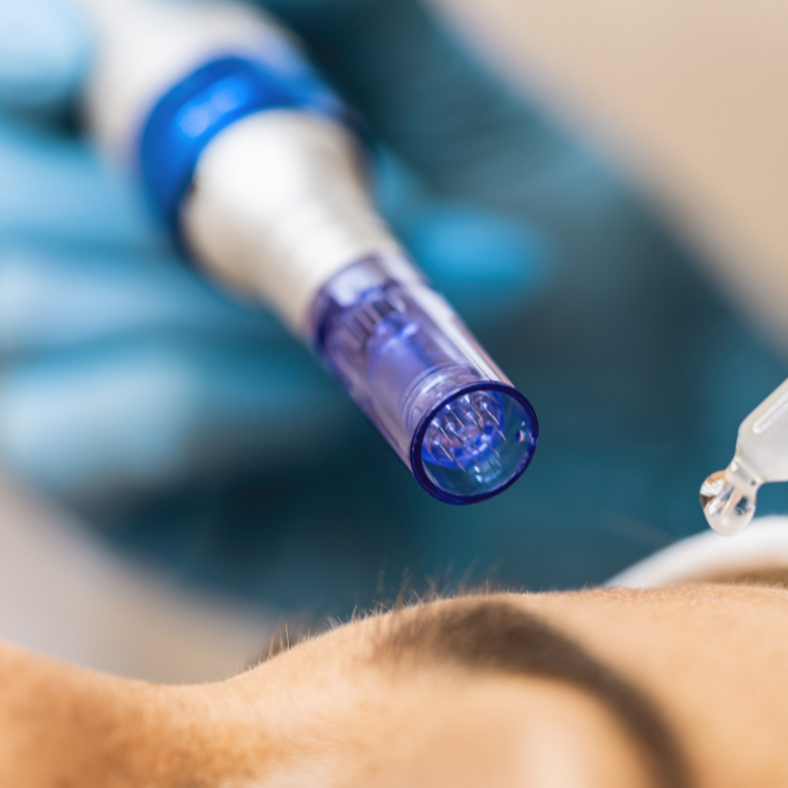 MICRO-CHANNEL-FUNDAMENTAL FACE/NECK at Inner Glow Skin Care in Conifer, CO