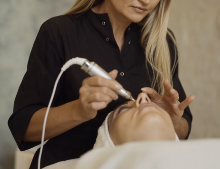 Microneedling  (Face)