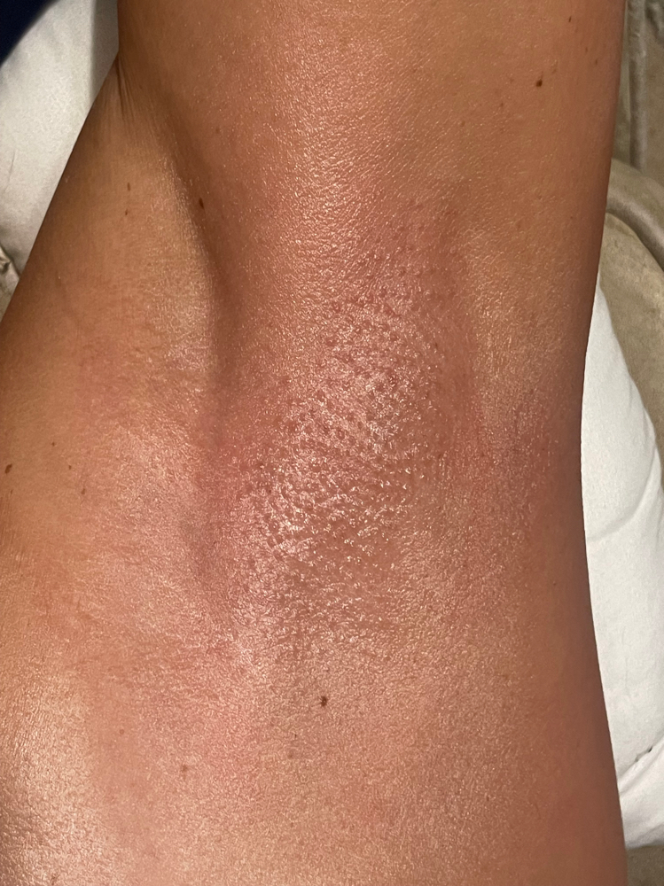 Underarm Wax