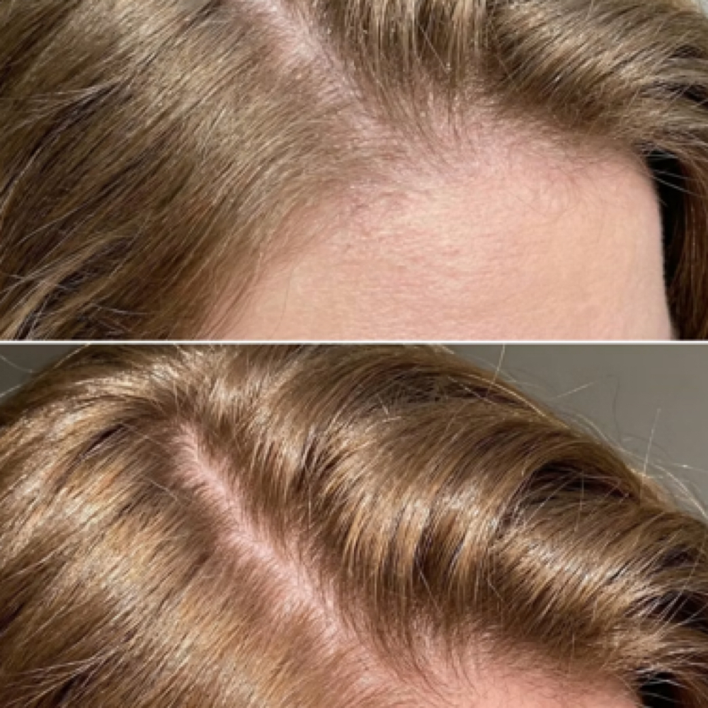 Scalp Analysis | Analysis Cuero Cab at Creativav Salon and Spa in Georgetown, TX