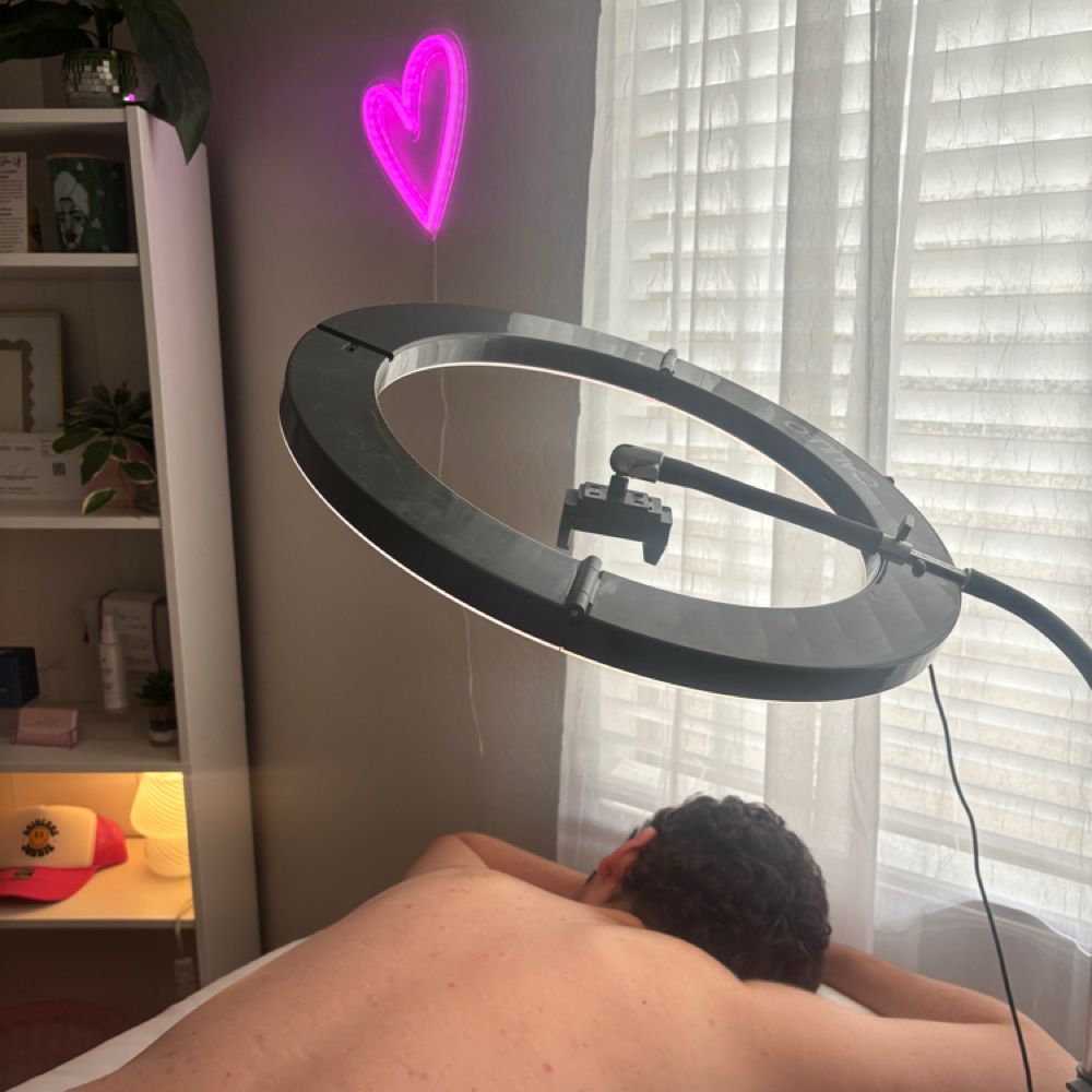 Back Treatments at Luv U Aesthetics in Goodyear, AZ
