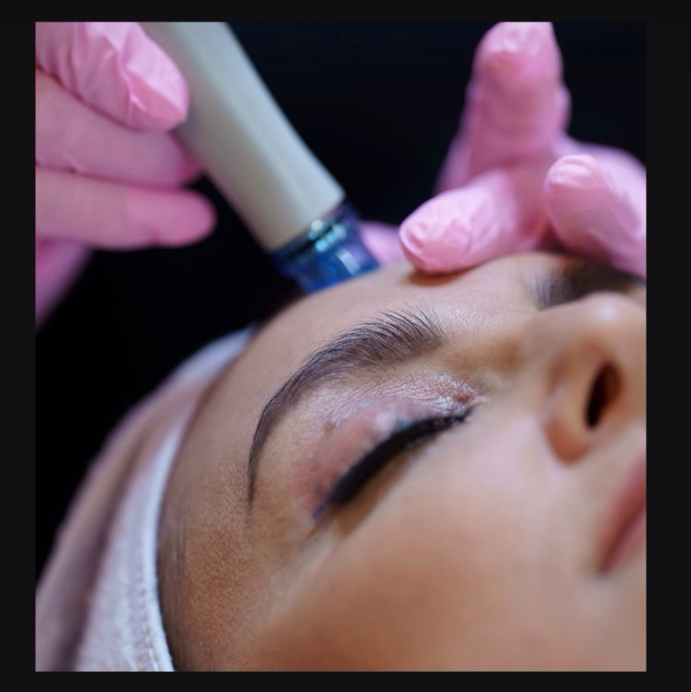 HydroFacial