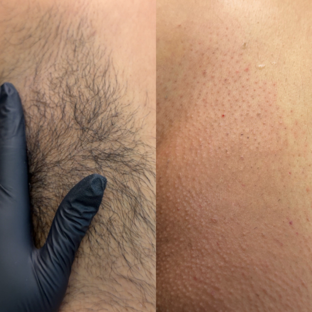 Brazilian Wax at Con Cora Esthetics in Long Beach, CA
