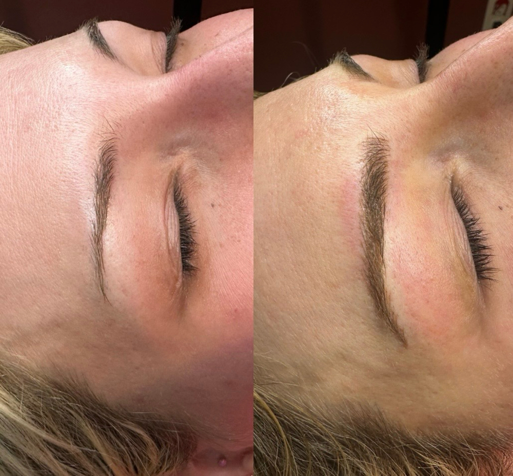 Microblading