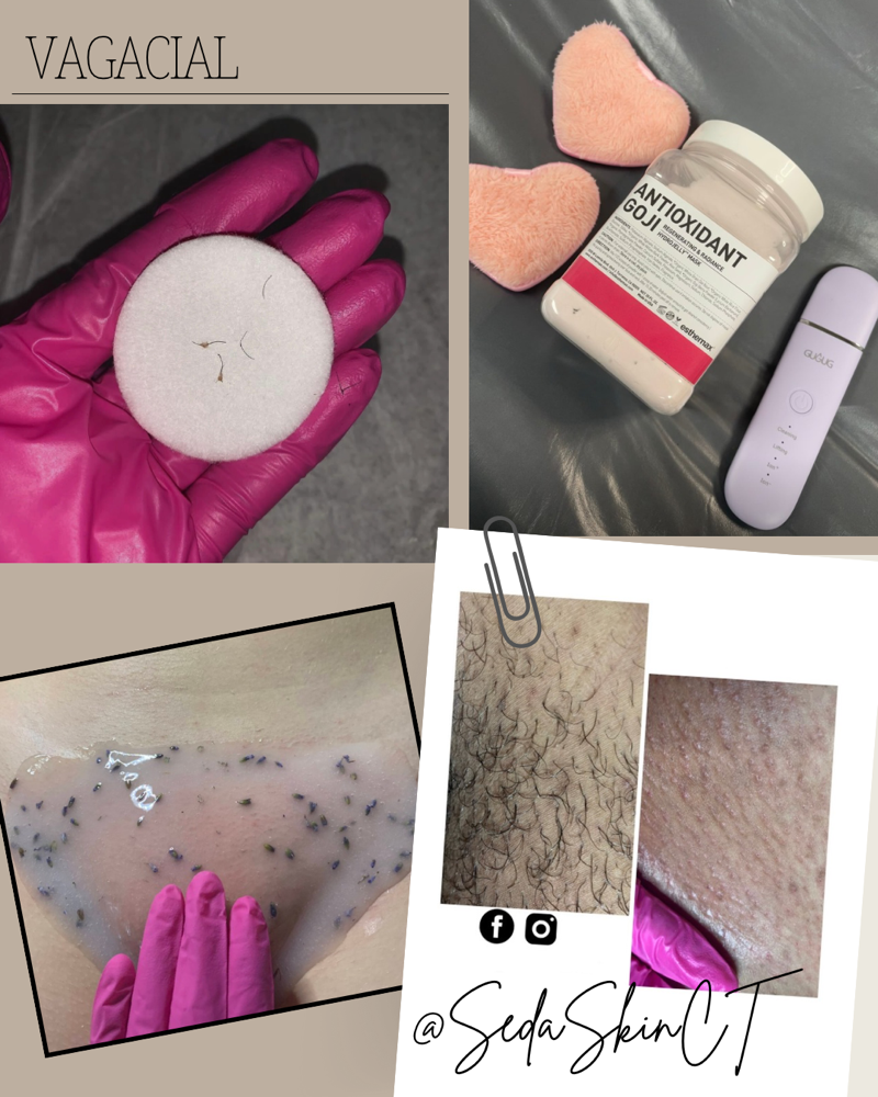 Brazilian Wax + Vagacial
