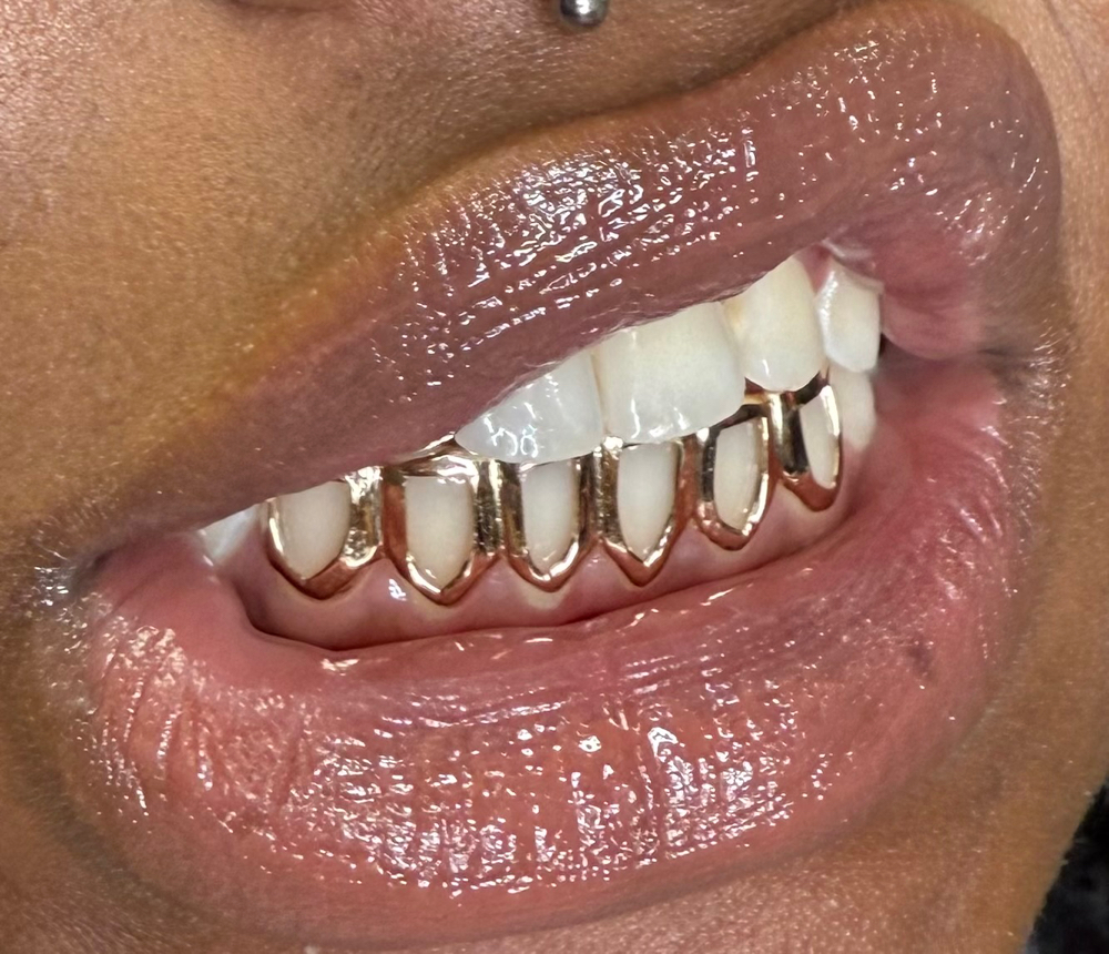 Grillz Pick Up