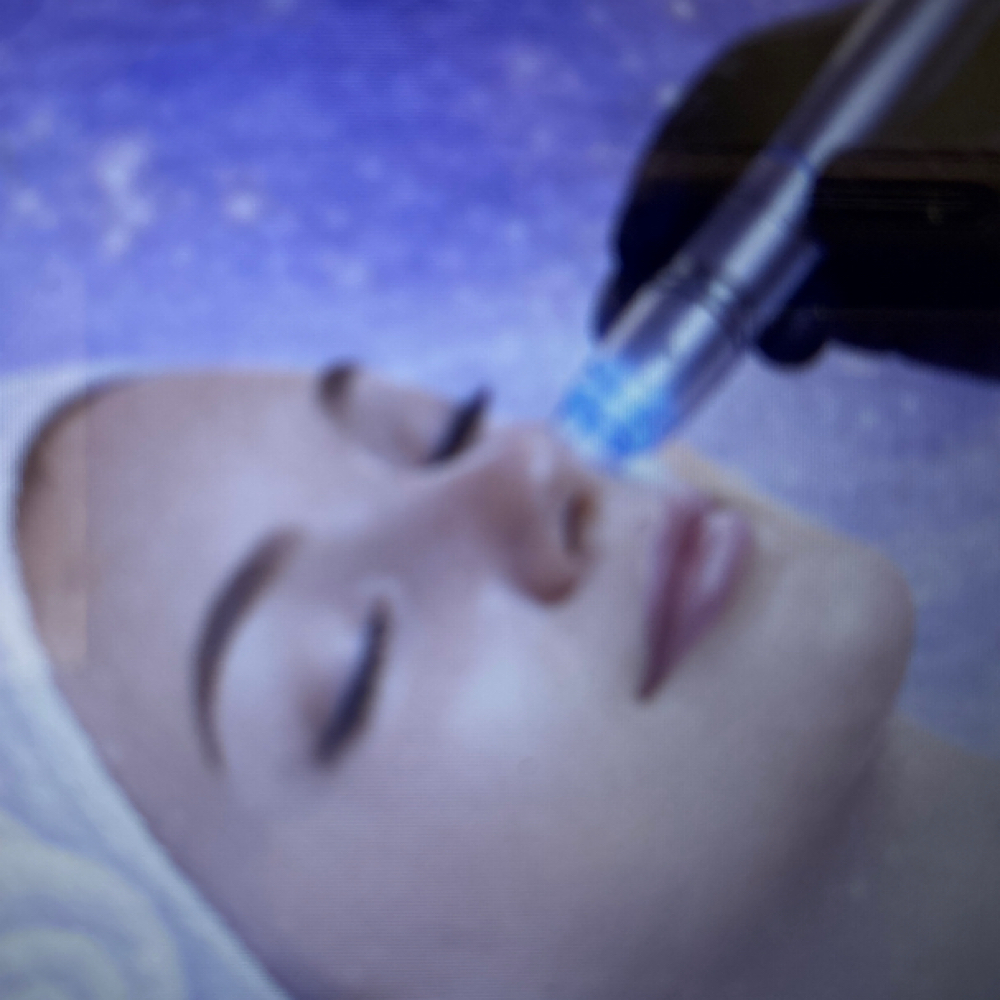 Nano-infusion w/ Rezenerate at Skin by Anna in Marianna, FL