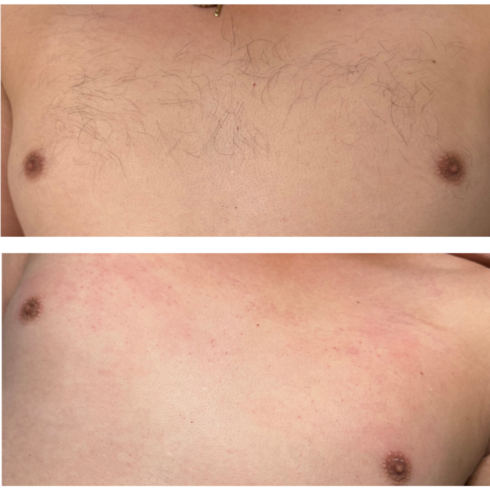 CHEST at The Lash & Beauty Lounge LLC in Pearland, TX