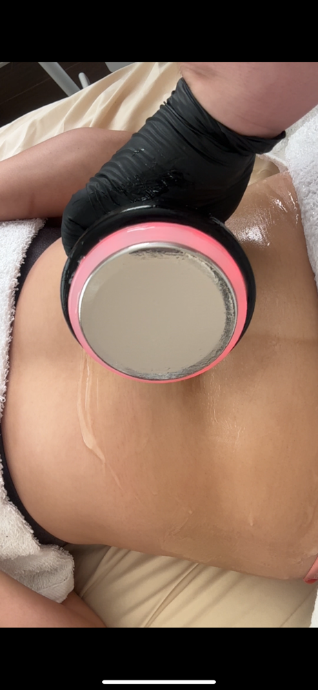 360 Body Sculpt Tox
