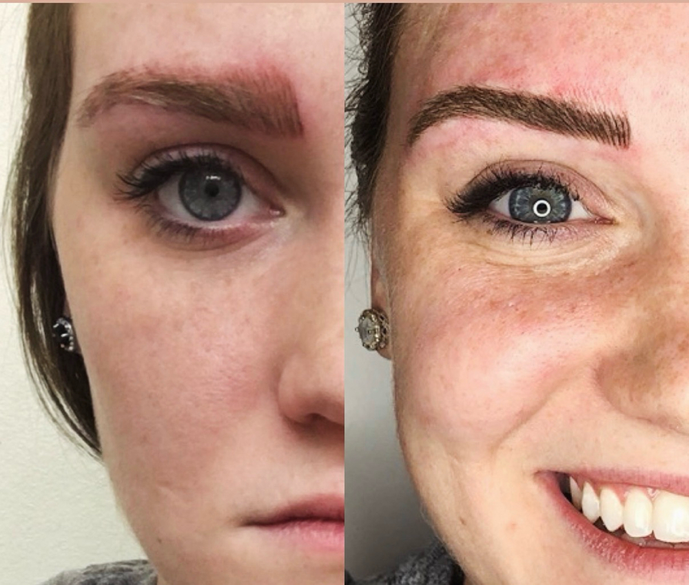 THEE BEST correction