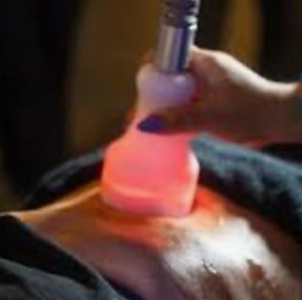 Cyro Therapy Sculpting at Bliss Beauty Bar in Houston, TX