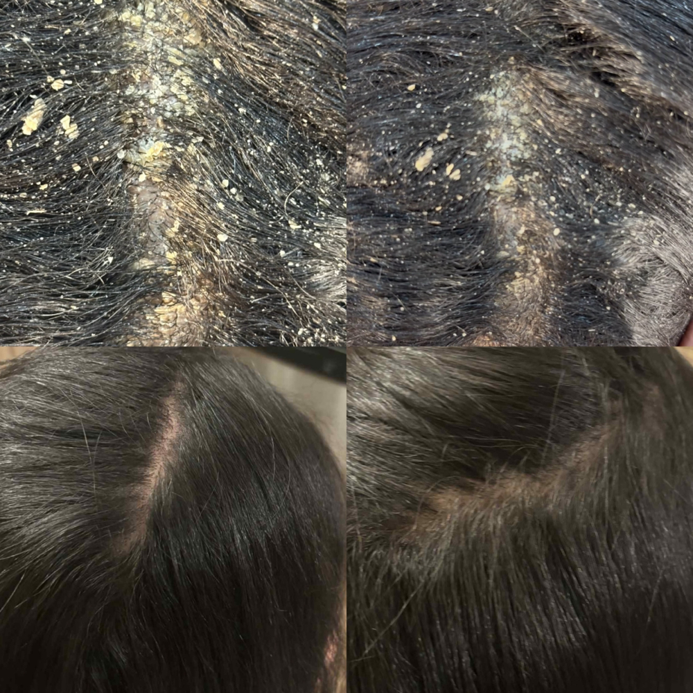 ScalpScope™ Analysis + Treatment