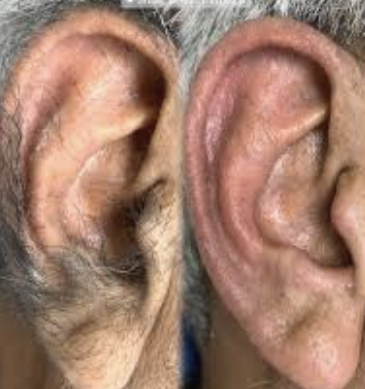 Ears