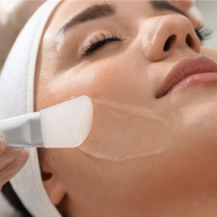 Facial - Add Peel at DM Laser Skin Care Solutions in Needham, MA