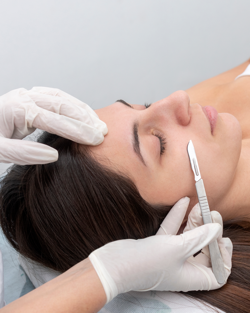 Dermaplaning Skin Treatment at B’You Aesthetics Lounge in Pharr, TX
