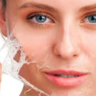 Chemical Peels; by Consult only at MUSE Beauty Lounge in Taylor, TX