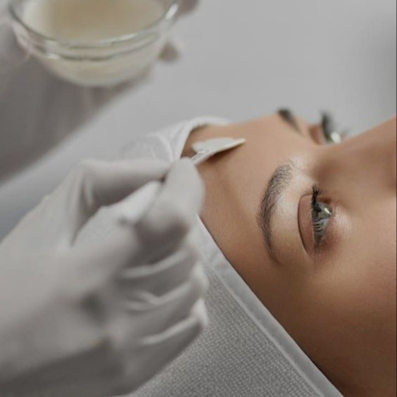 Radiance Reveal Chemical Peel at AGELESS SKIN BY ASEEL MED SPA in Prosper, TX