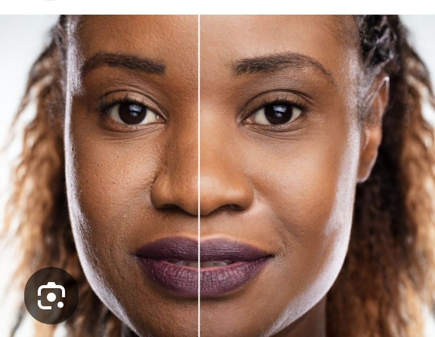 Diamond Microdermaabrasion