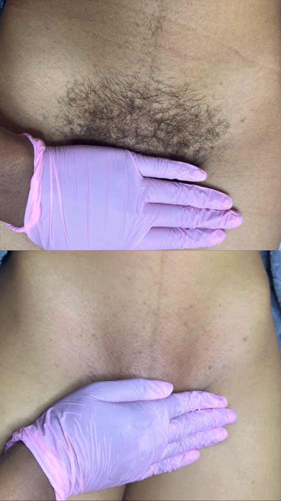 Brazillian Wax