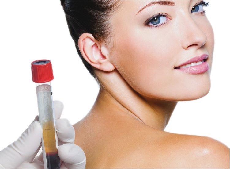 Plasma Rico en Plaquetas Facial