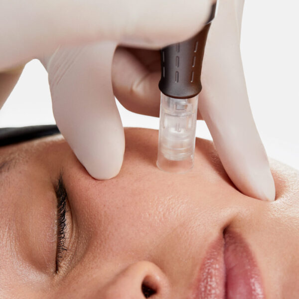 Nano-Infusion