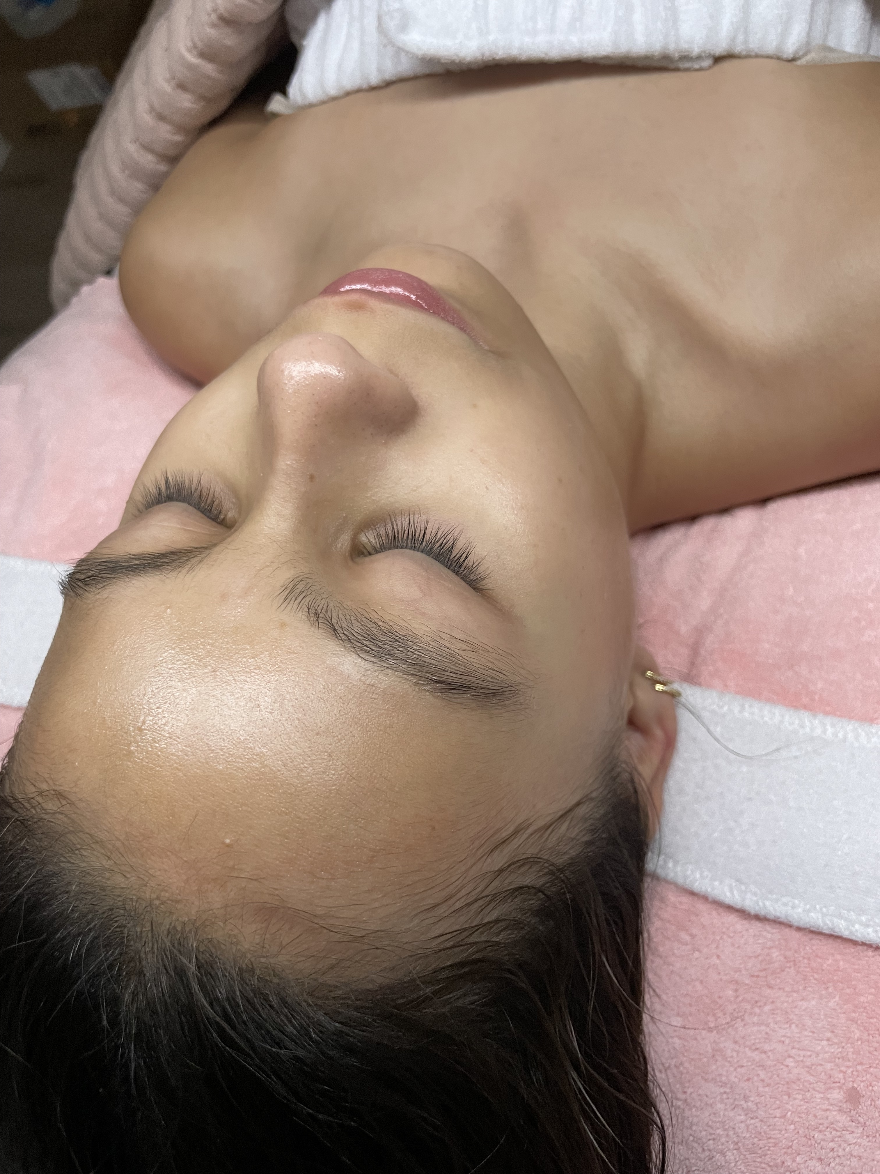 Teen Facial