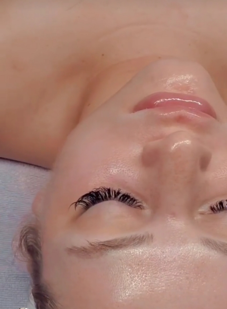 Rejuvenation Facial