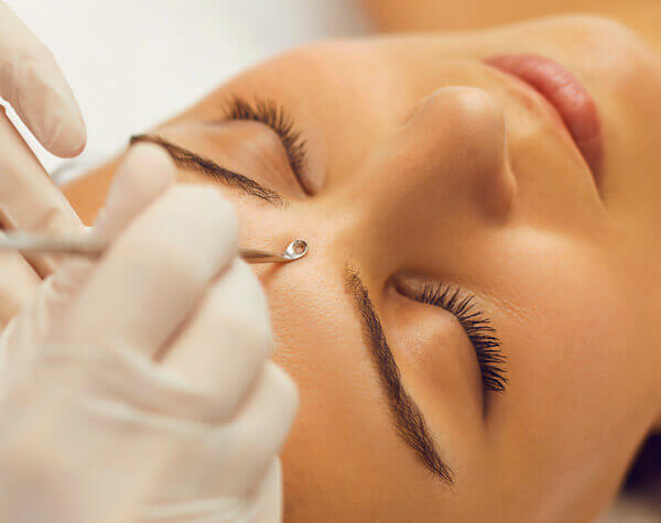 Extraction Facial