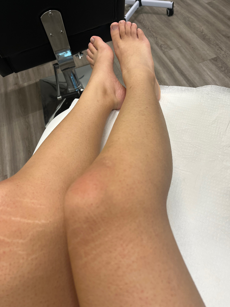 Full Leg