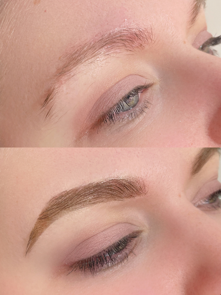 Brow Consultation