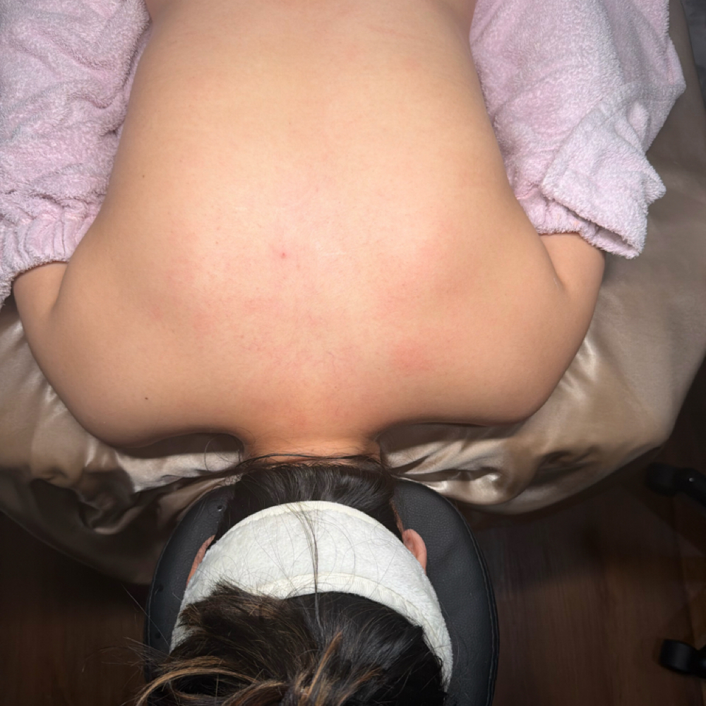 Back Facial✨♨️♨️ at Radiant Beauty By Selene in Fresno, CA