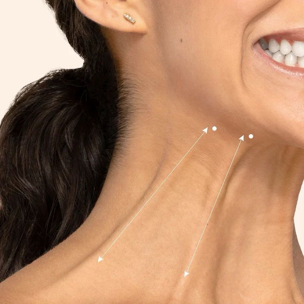 DAXXIFY- Platysma Bands/ Cuello 30U at Lumé Aesthetics in Pharr, TX