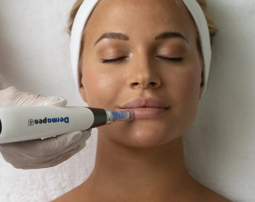 Derma Pen