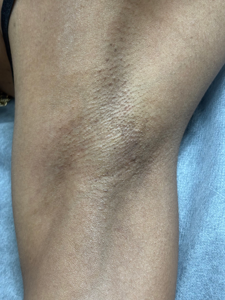 Underarm Wax