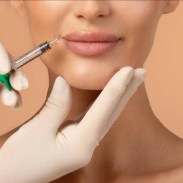 Lip Filler at E.V. Aesthetics in Torrance, CA