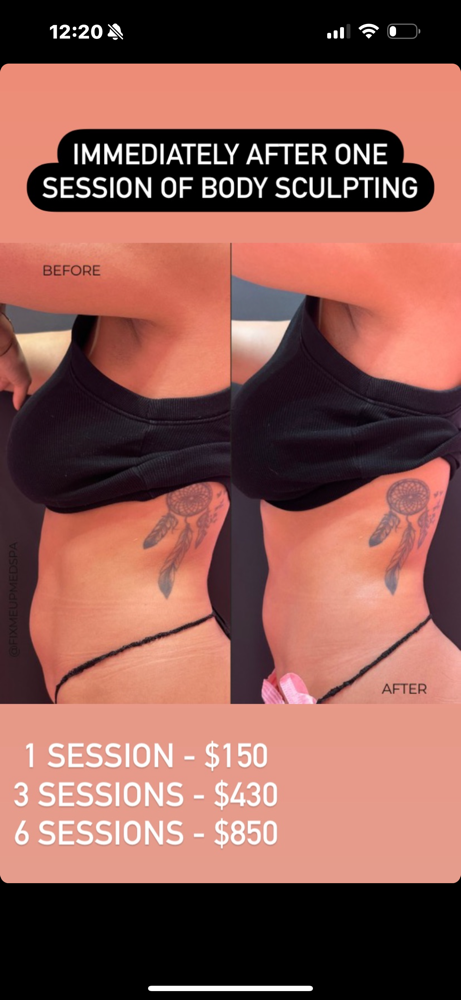 Abdomen Aparatologia