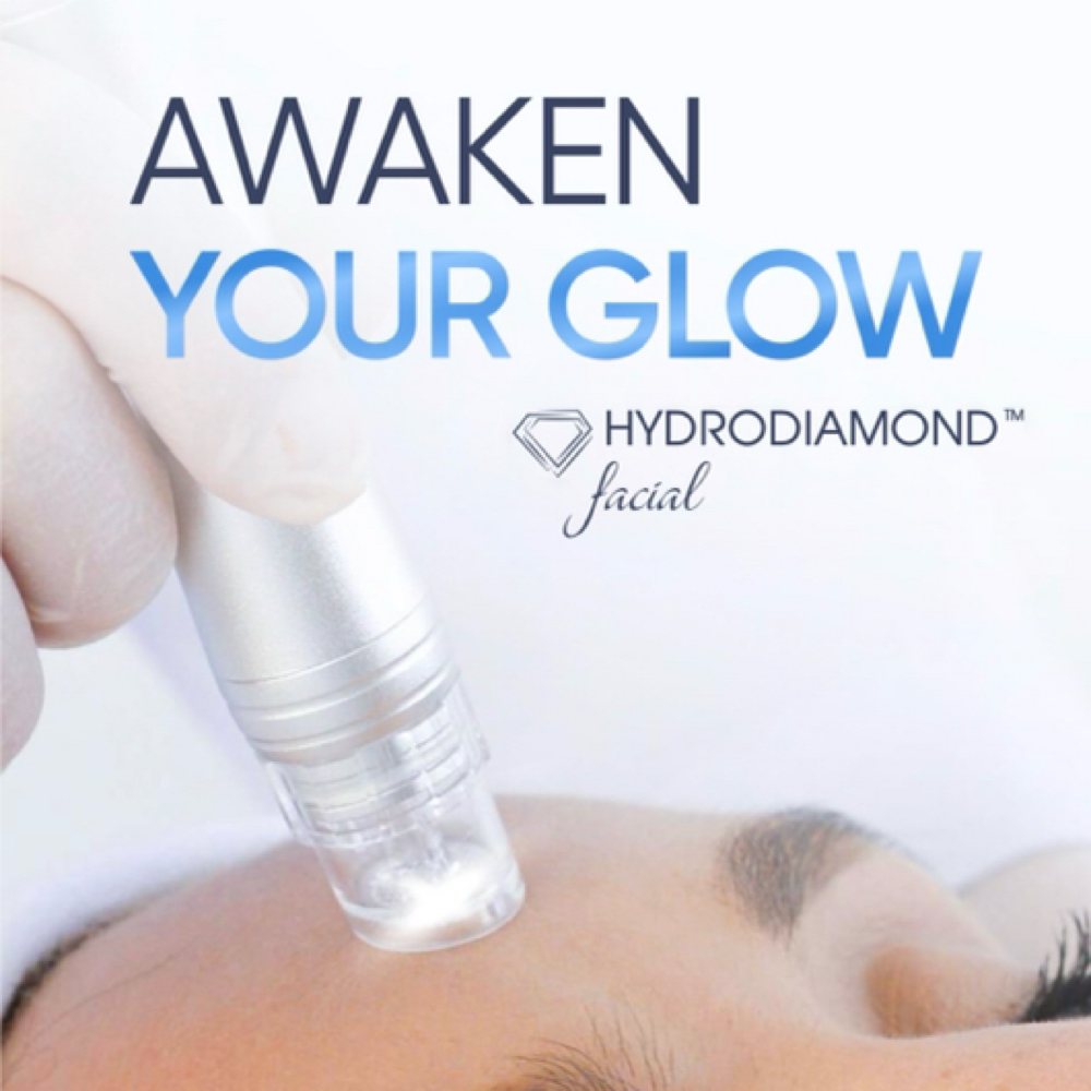 Hydro-Radiance Facial (special) at Alexa Does Esthetics LLC in Garland, TX