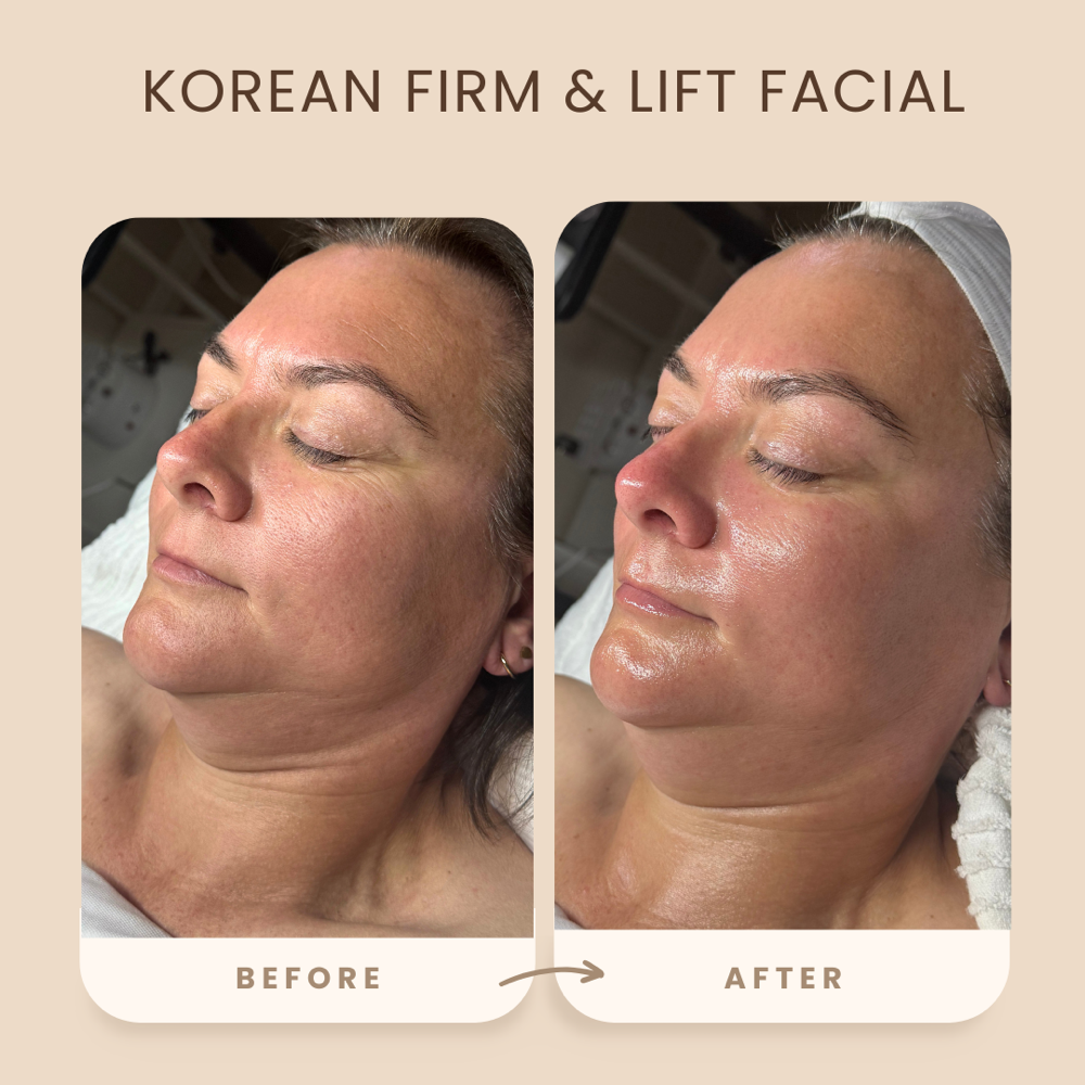 Korean Firm & Lift Facial