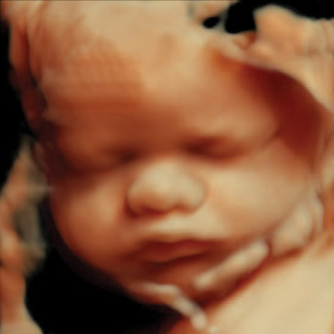 The Sweet Baby Experience 3D / 4D