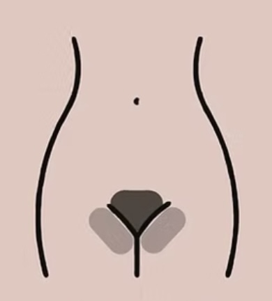 Bikini Line Treatment