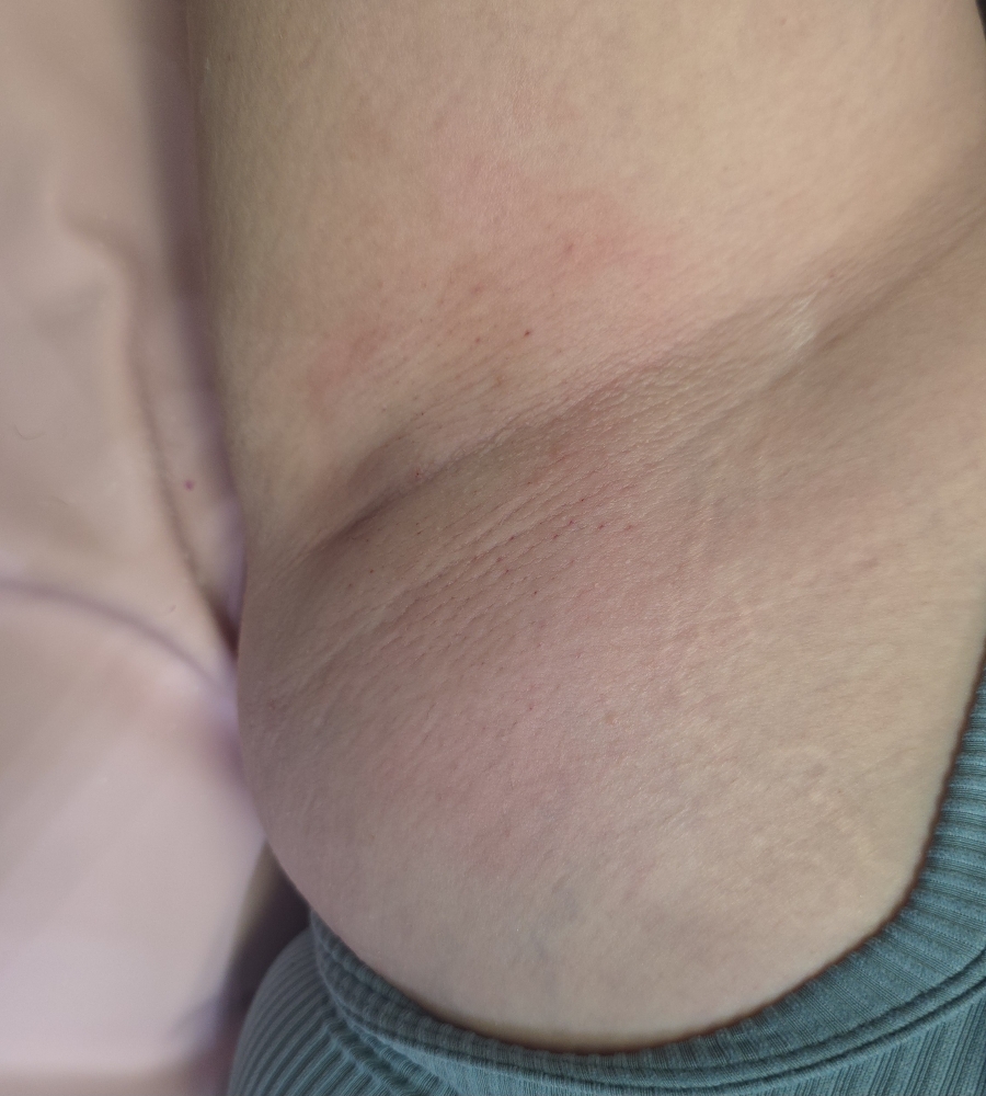 Under Arm Wax