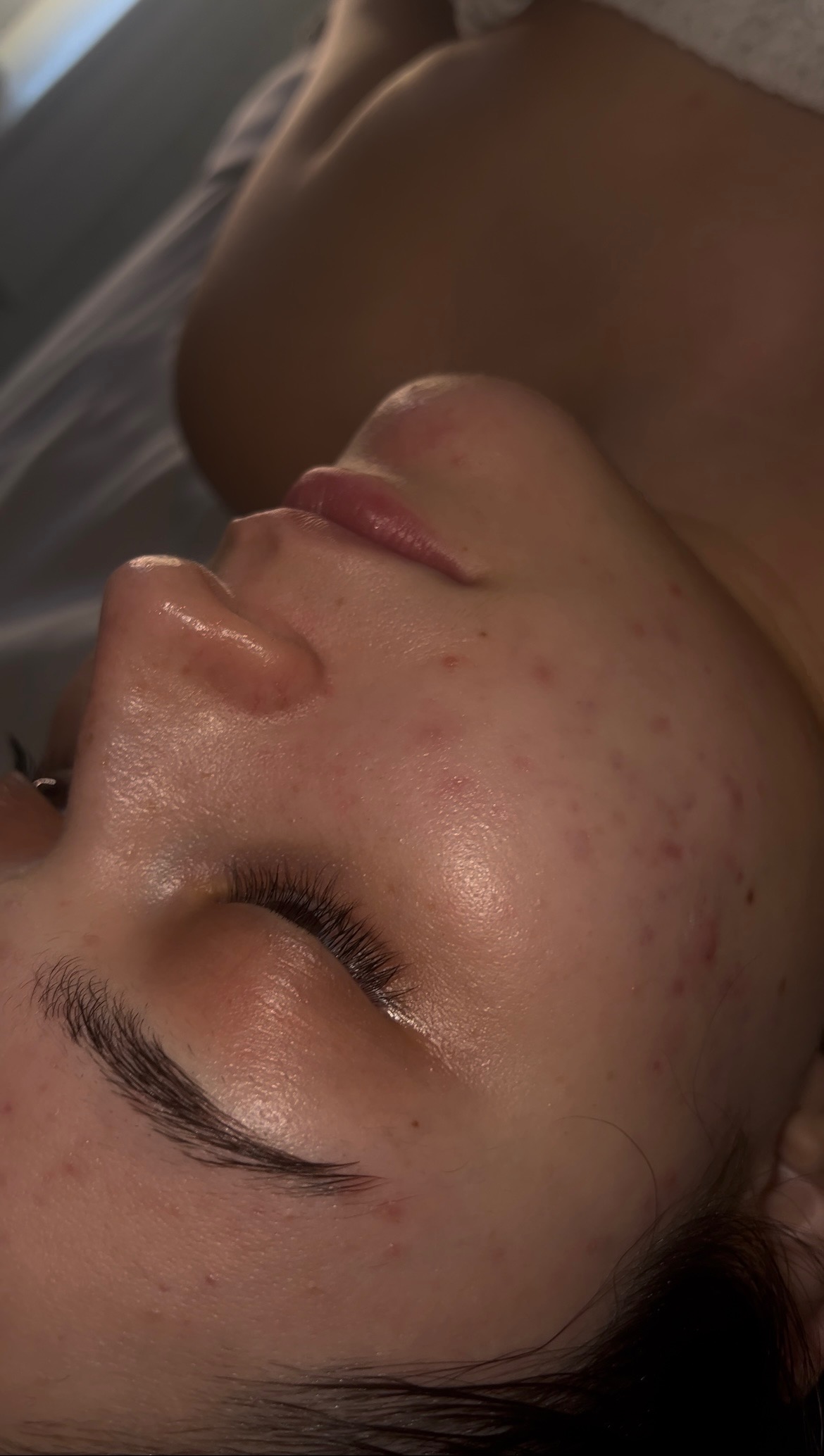 30min facial