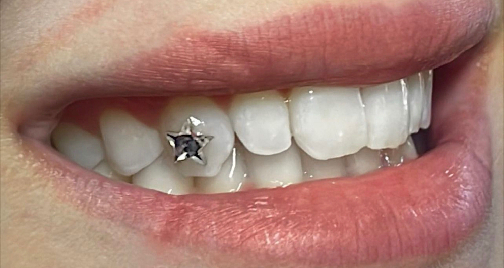 Shaped Tooth Gem