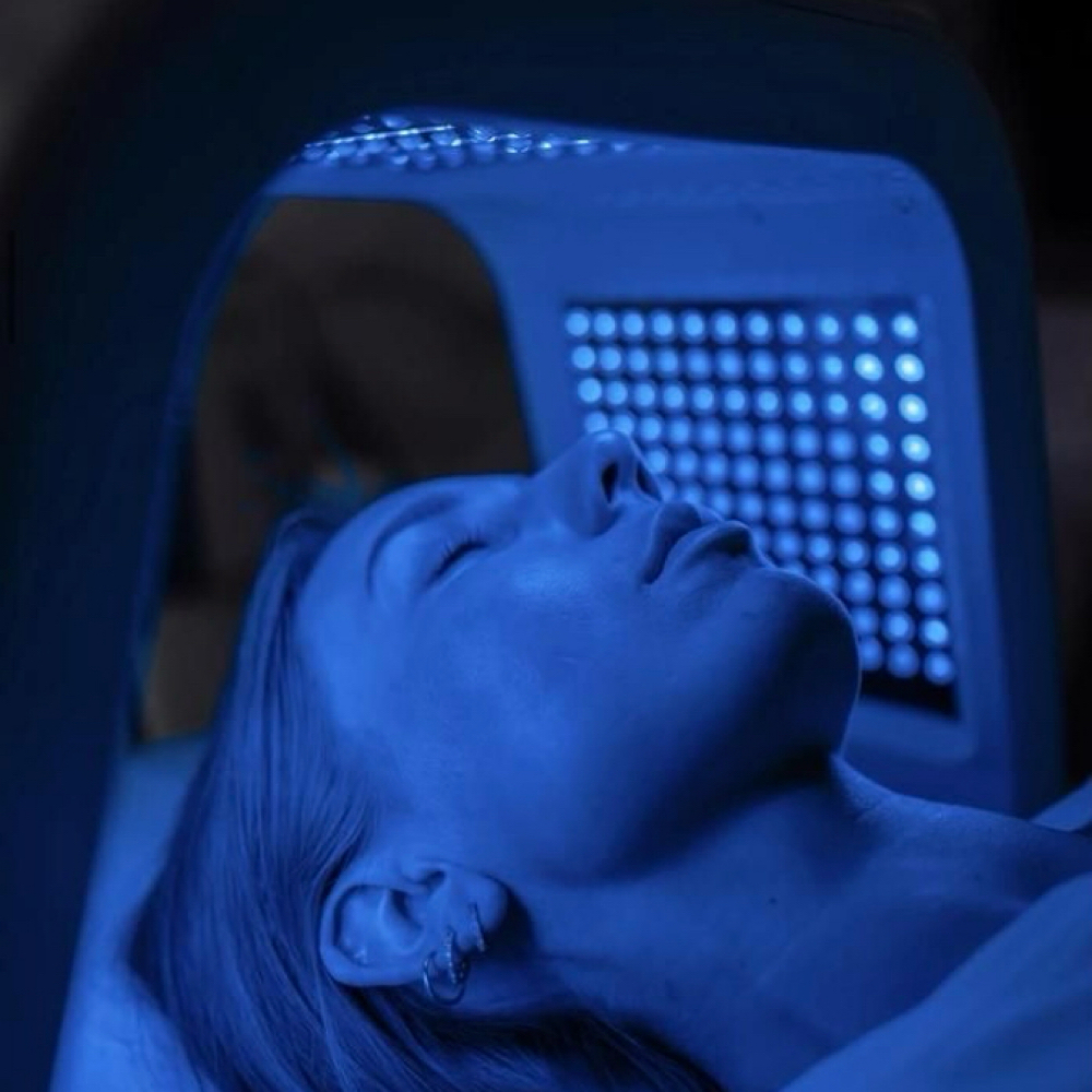 Acne Facial at Marie Skin & Co. in Escondido, CA