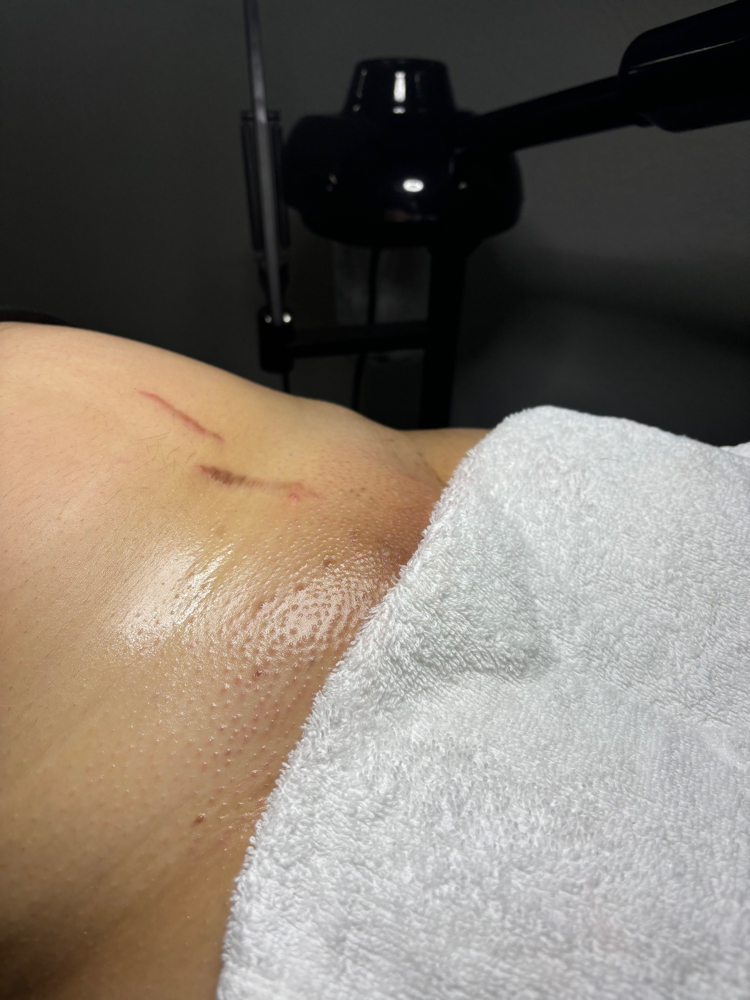 PROMO BRAZILIAN+UNDERARMS